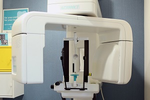 歯科用CT