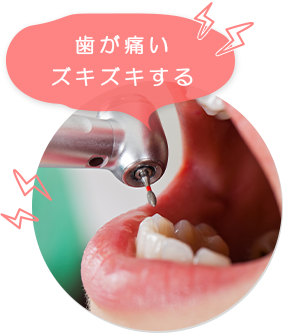 歯が痛いズキズキする