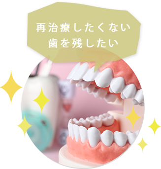 再治療したくない歯を残したい