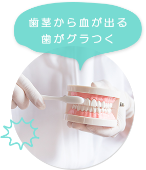 歯茎から血が出る歯がグラつく